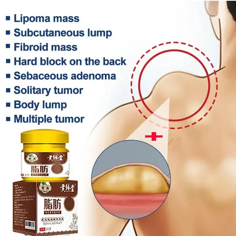 

Lipoma Removal cream Skin Repair And Deep Penetration Cellulite Lotion For Fat Hard Lumps