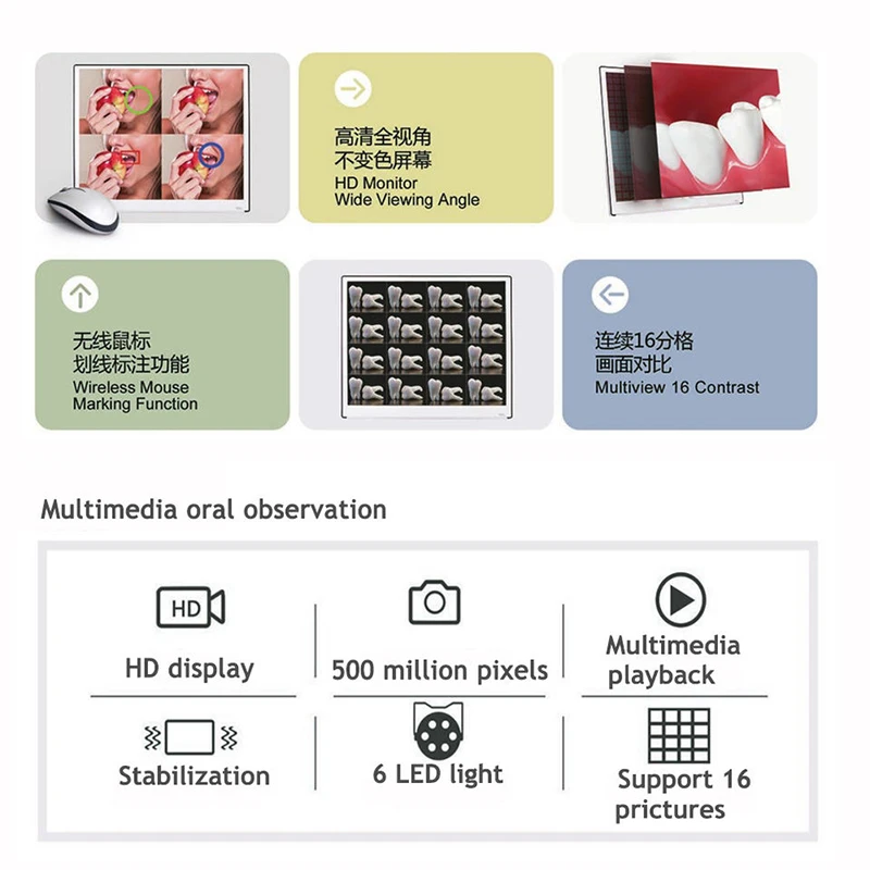 TJDent 17 นิ้วทันตกรรม Intra Oral กล้อง HDMI ความละเอียดสูง Intraoral กล้อง Digital Monitor Intraoral ทันตแพทย์เครื่องมือเครื่องมือ