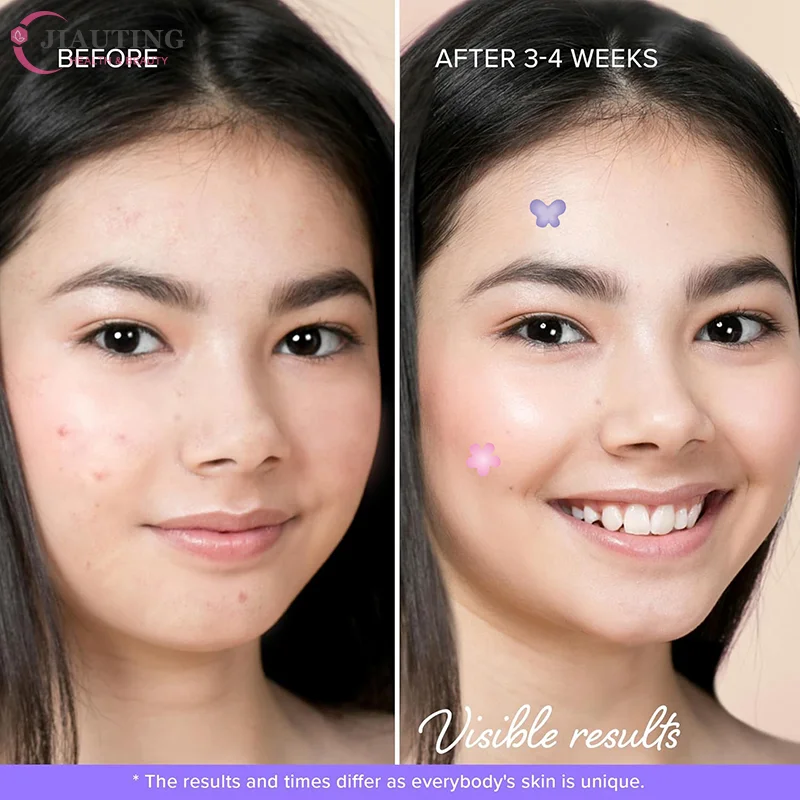 100/120PC Patch สิวดอกไม้สิว Patch สิวที่มองไม่เห็นกําจัดสิว Skin Care สติกเกอร์คอนซีลเลอร์ Face Spot เครื่องมือแต่งหน้าความงาม