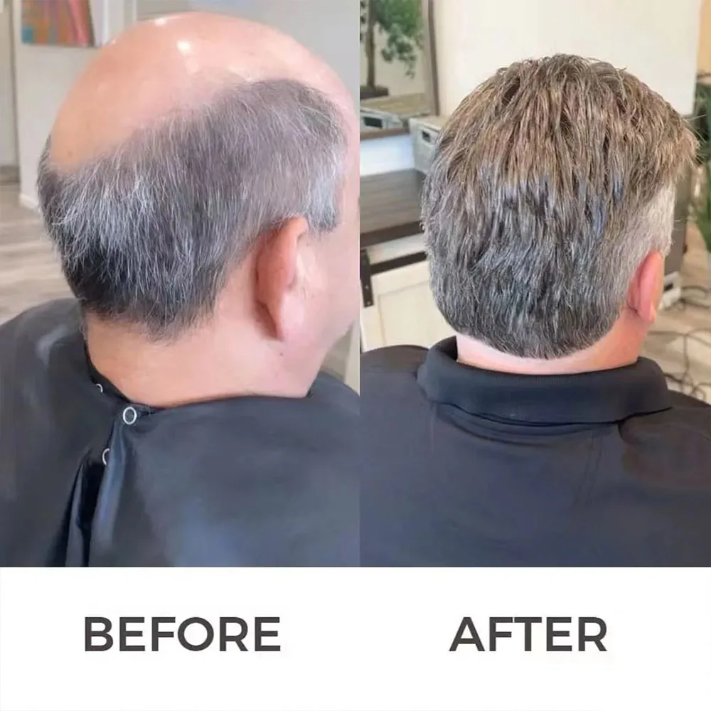 Grey Human Hair Prosthsis Breathable Mono Lace Mens Wig System Toupee for Men Hairpiece Natural Hairline Male Wig Unit
