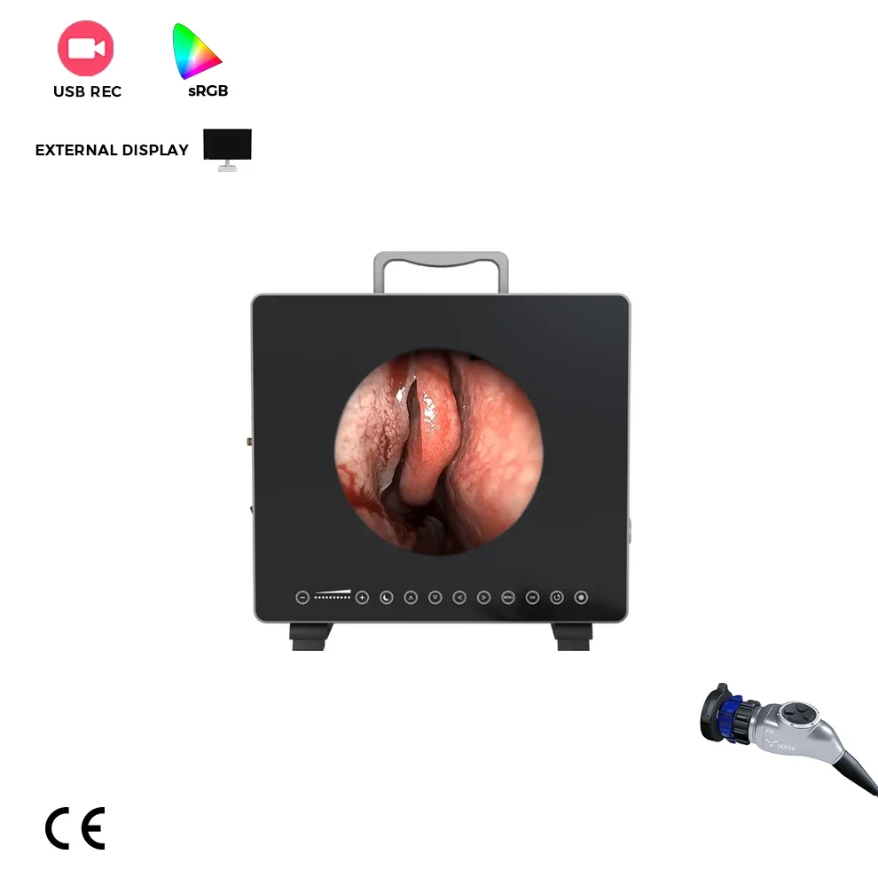 OEM Factory SD FHD Medical Endoscopic  System Portable ENT Nasal Surgery Endoscope Equipment