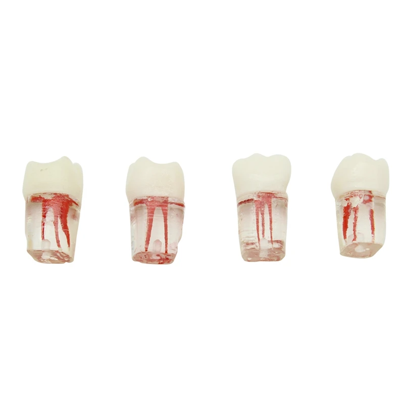 4pcs Dental Tooth Model Root Canal Block RCT Practice Teeth Pulp Cavity Resin Teeth Study Endo Training Model Dentistry Supplies