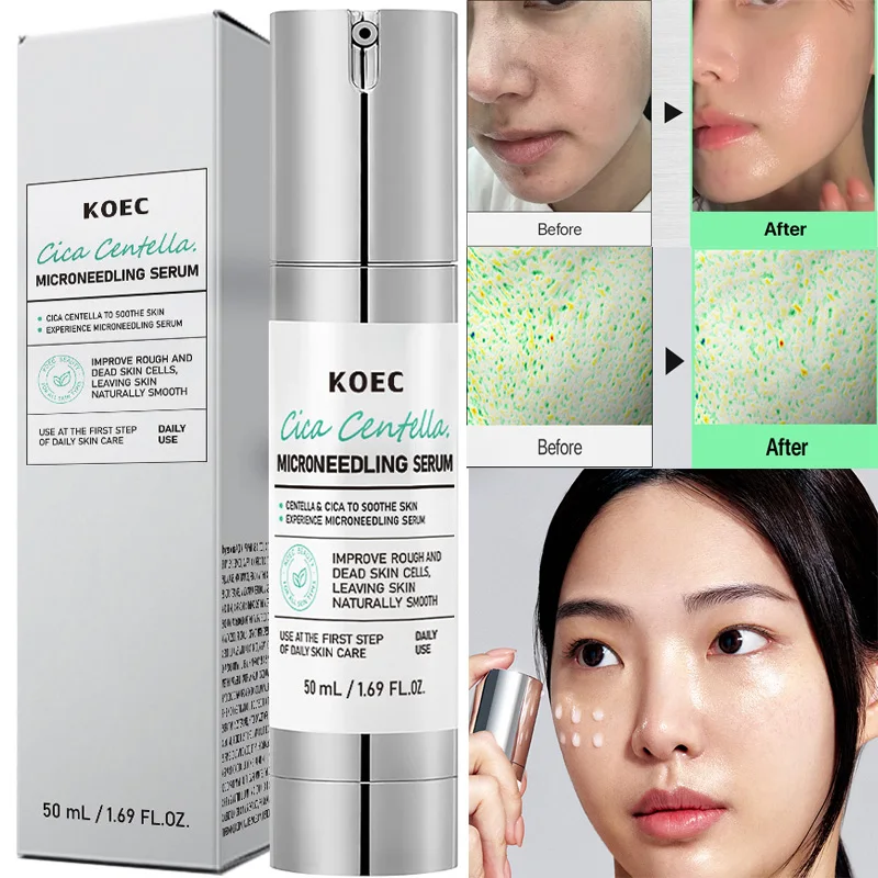 Korean Microneedle Essence Desalination Fine Lines Spots Collagen Solution Reverse Aging Recombinant Improves Rough Texture 50ml