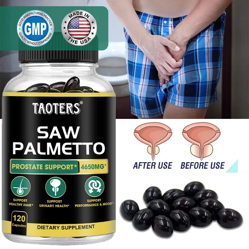 Saw Palmetto Prostate Support Supplement – for Men’s Prostate Health, Biotin for Hair Growth, Men’s Health, Urinary Tract Health