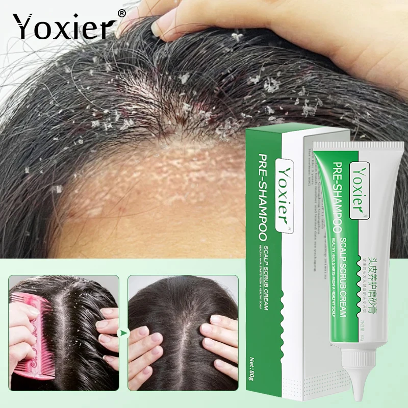 Pre-Shampoo Scalp Scrub Clean Remove Dandruff Folliculitis Oil Control Prevent Hair Loss Repair Damaged Regrowth Nourishing 80g