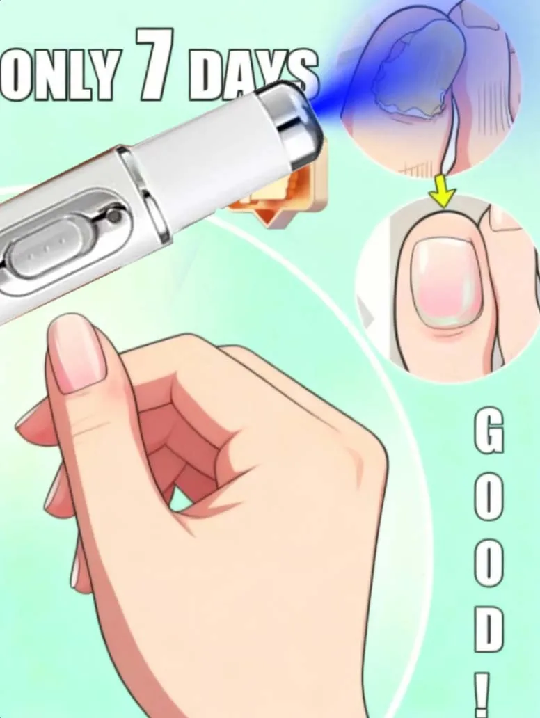 

Ручка Nwe Blue Light Быстро удаляет грибок маникюра, самый продаваемый инструмент для ухода за маникюром 3.