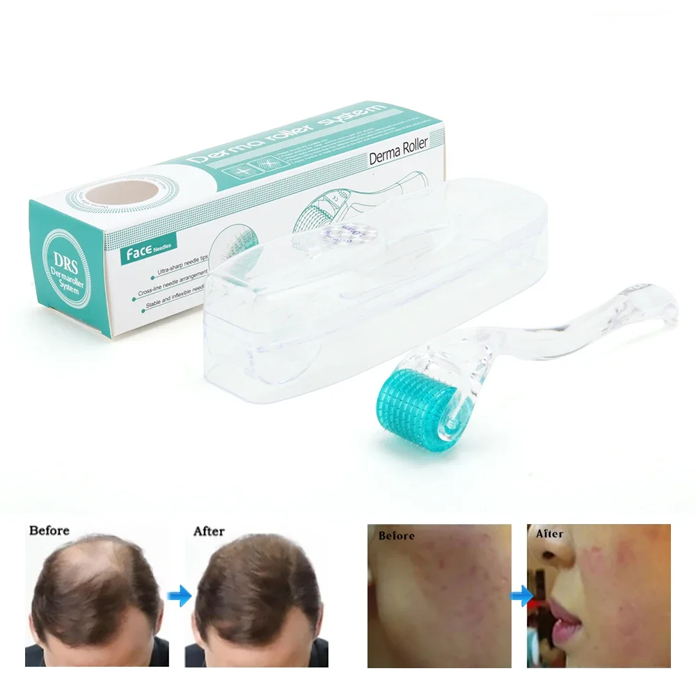 192 Real Needle Dermaroller Face Skin Care Derma Roller for Beard Scalp Hair Growth and Acne Scar MTS Microneedling Mesotherapy