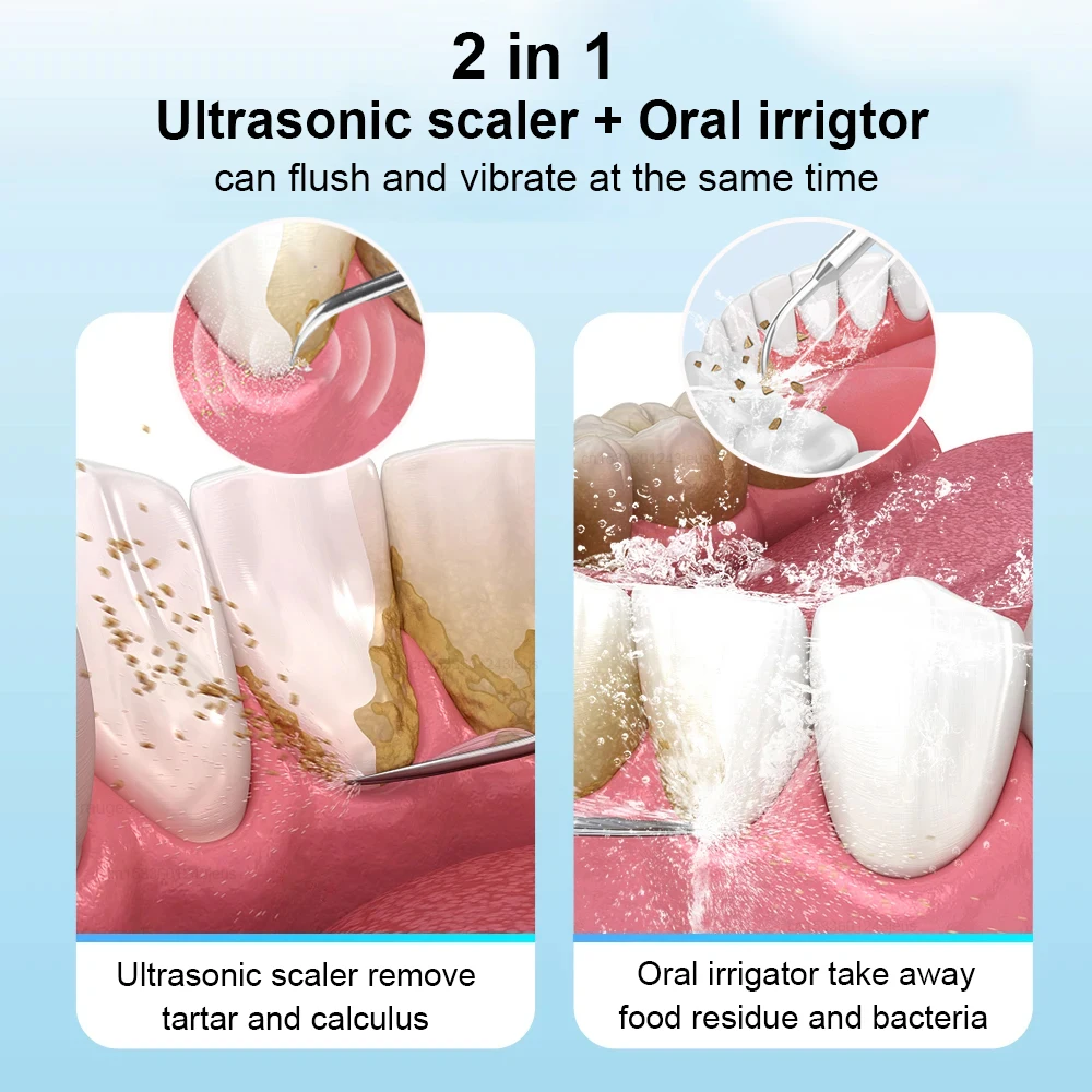 Dental Oral Irrigator Water Flosser for Teeth Ultrasonic Dental Tartar Eliminator Ultrasound Tartar Cleaner Calculus Remover