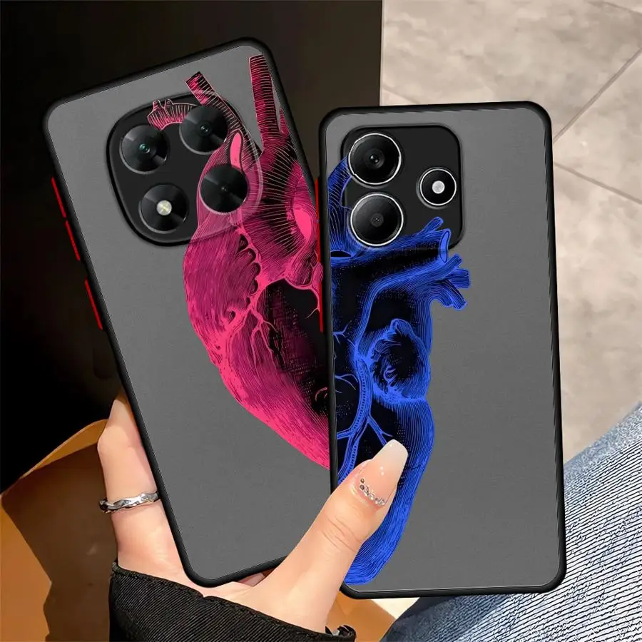 Soft Cover Case For… - image