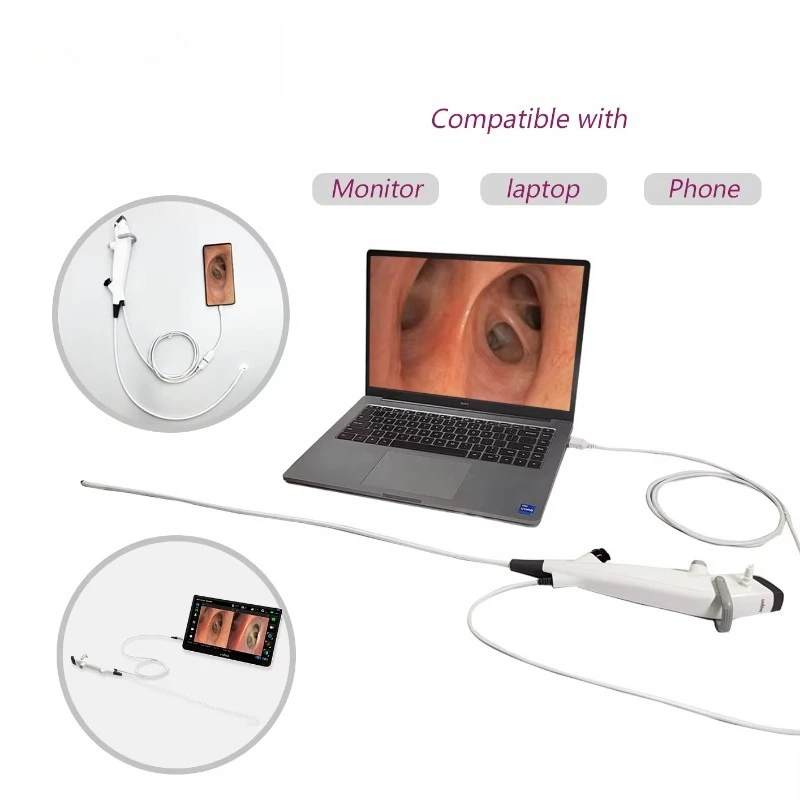 Semi-reusable veterinary endoscope, flexible design with operation channel, suitable for foreign body extraction in dogs and cat