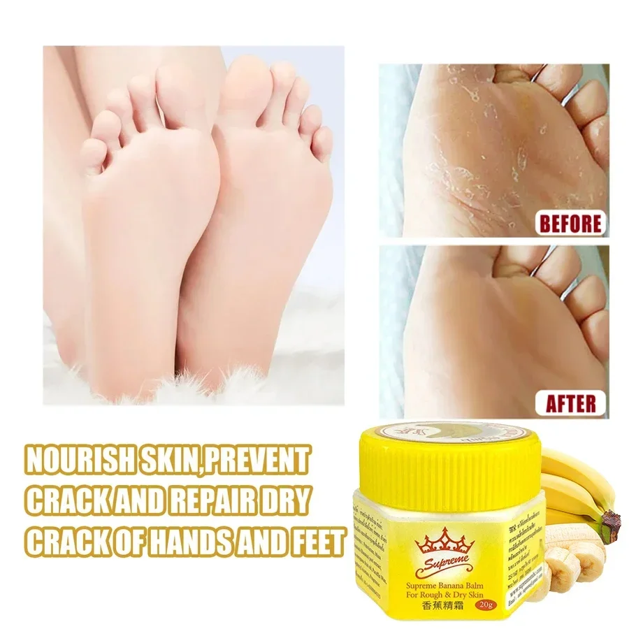 Gels hydratants pour les mains et les pieds, huile anti-sécheresse, crème réparatrice pour talons fissurés, essence de soin