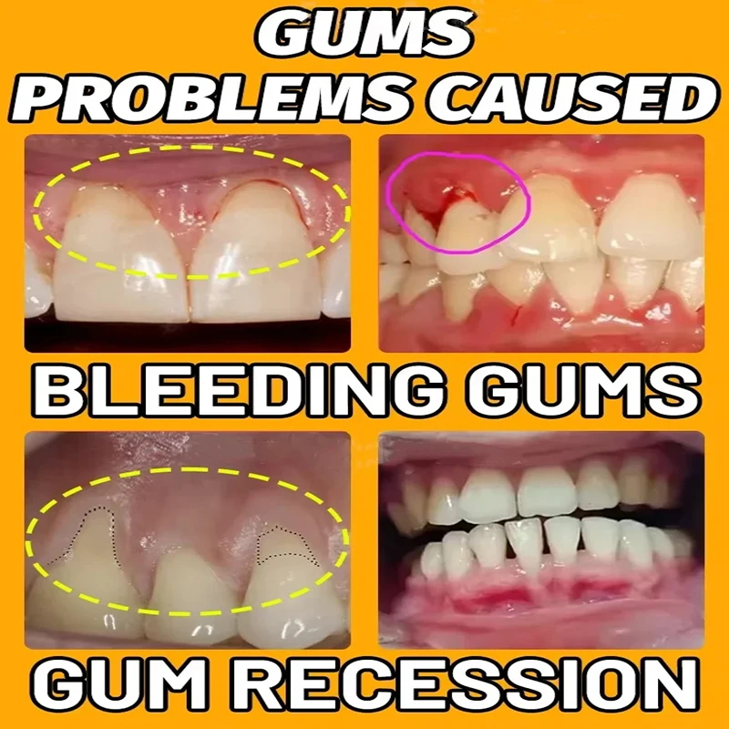 Whitening Teeth Essence effectively repair damaged gums Remove stains Clean teeth Oral dental care relieves swelling gums Expert