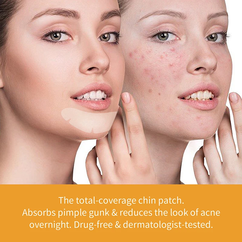 10 pz Acne Patch Riparazione Macchia Brufolo Strumento di Rimozione per il Viso Mento Fronte Traspirante Idrocolloide Adesivo Invisibile Cura Della Pelle
