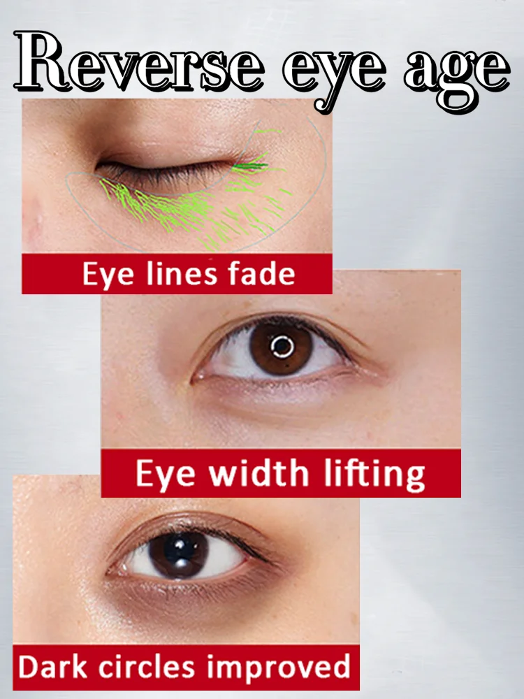Eye Cream Tightens The Skin, Removes Wrinkles, Delays Aging and Removes Wrinkles. Trouble Dark Circles and Bags Under The Eyes