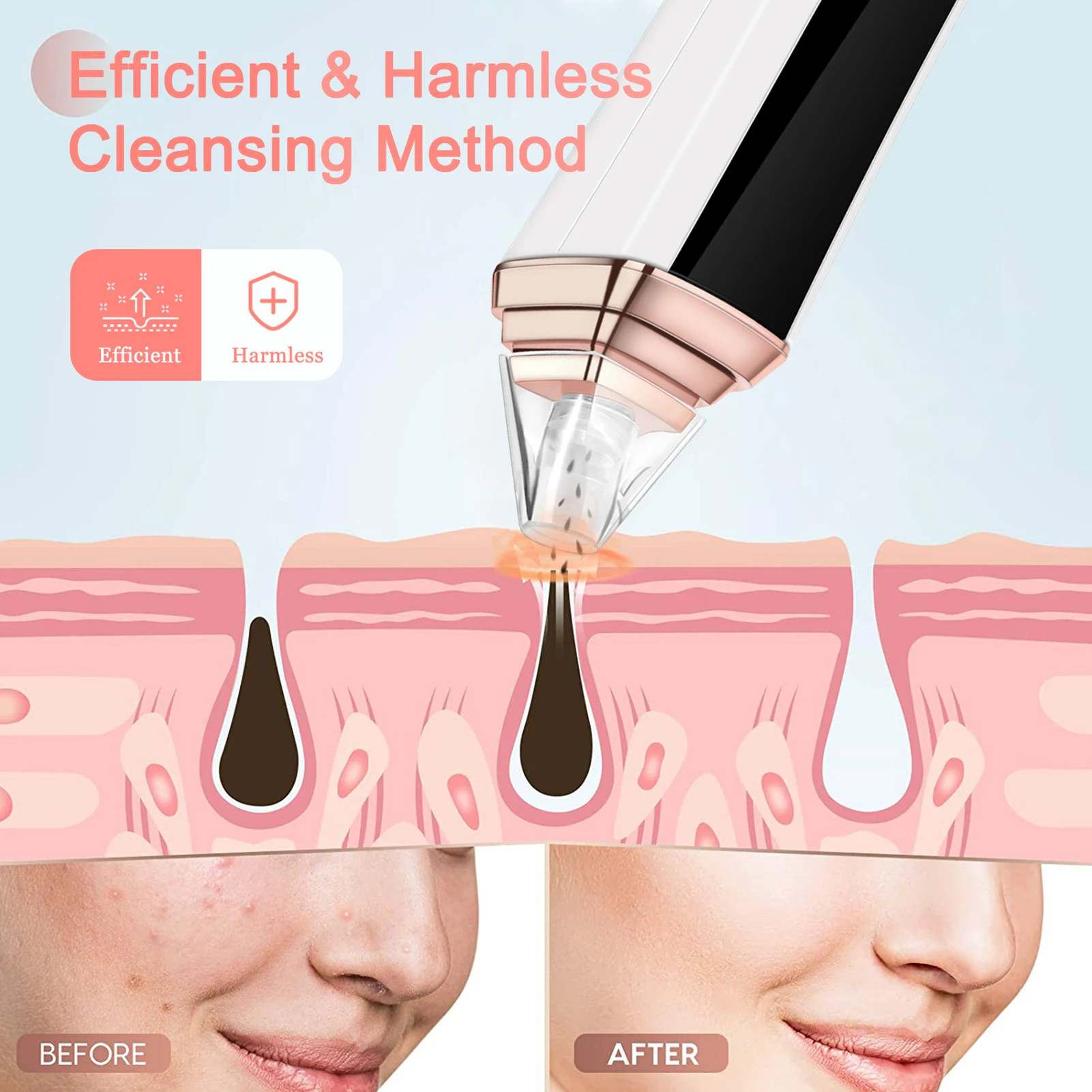 Reducing Acne Blackhead Pore Cleaner Adjustable Modes Blackhead Pore Cleaner for Removing Blackhead Acne and Cleaning Pore