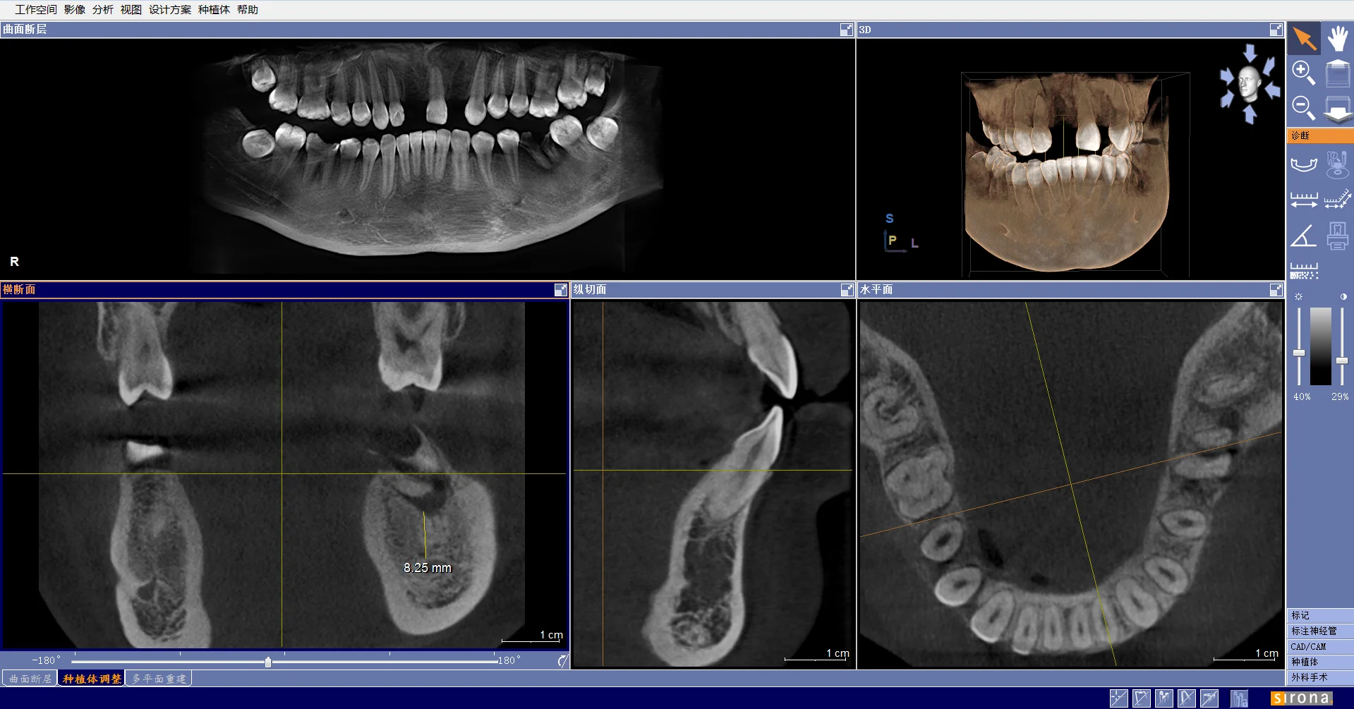 جهاز Orthophos XG 3D الماسح الضوئي الرقمي الب্যানোরামিক X Ray CBCT بسعر جيد