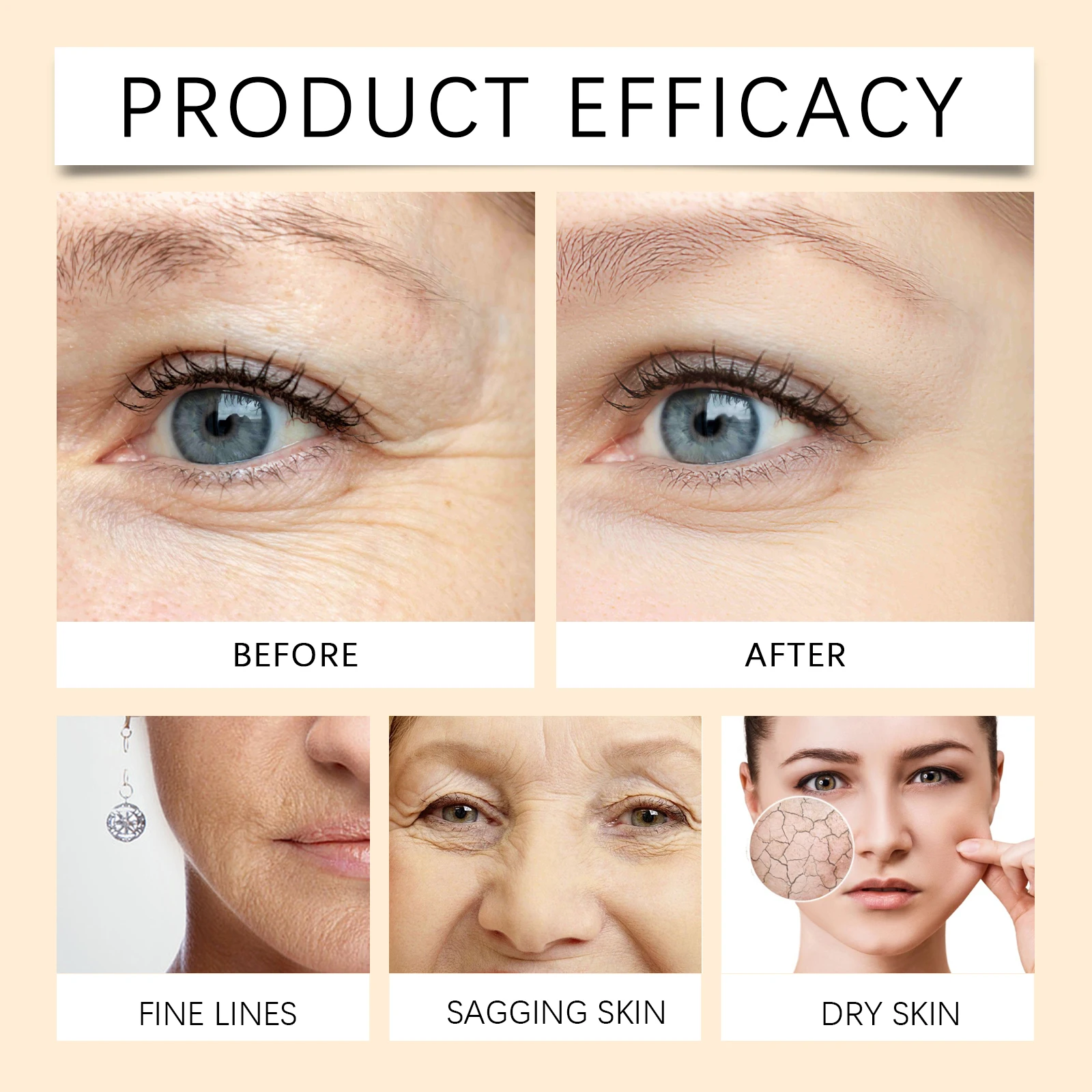 Hyaluronsäure Serum Gesicht Niacinamid Feuchtigkeitsspendende Aufhellung Creme Haut Reparatur Dunkle Flecken Entferner Essenz Gesichts Hautpflege Set