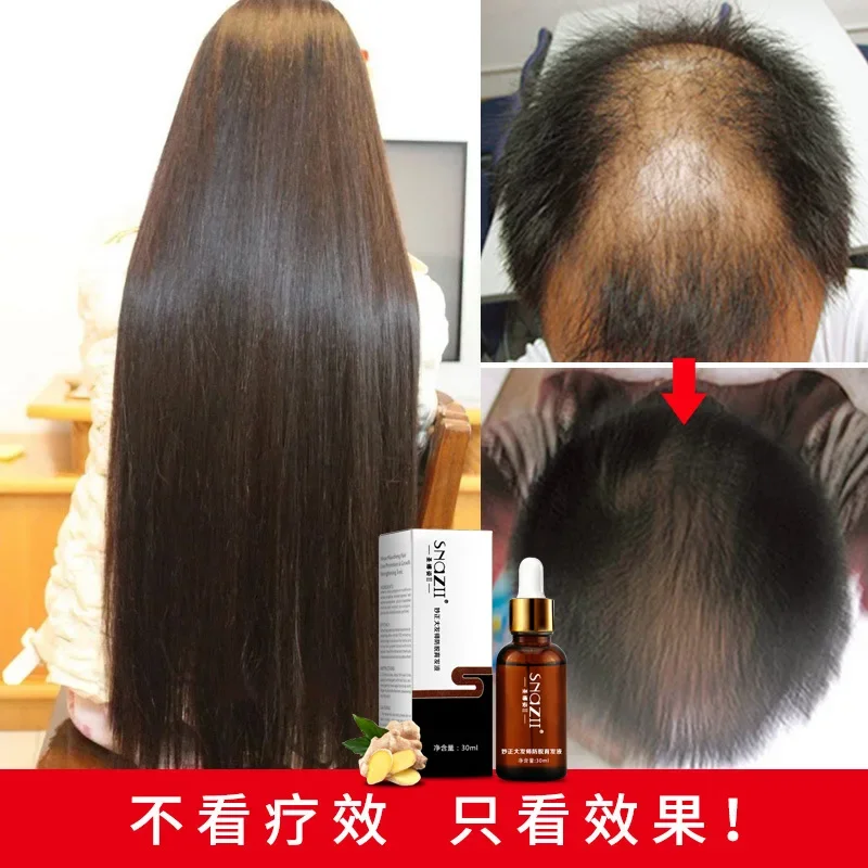 Original Andrea Hair Growth Essence Oil Liquid 30ml, Faster Hair Grow, Yuda Pilatory Stop Hair Loss Products