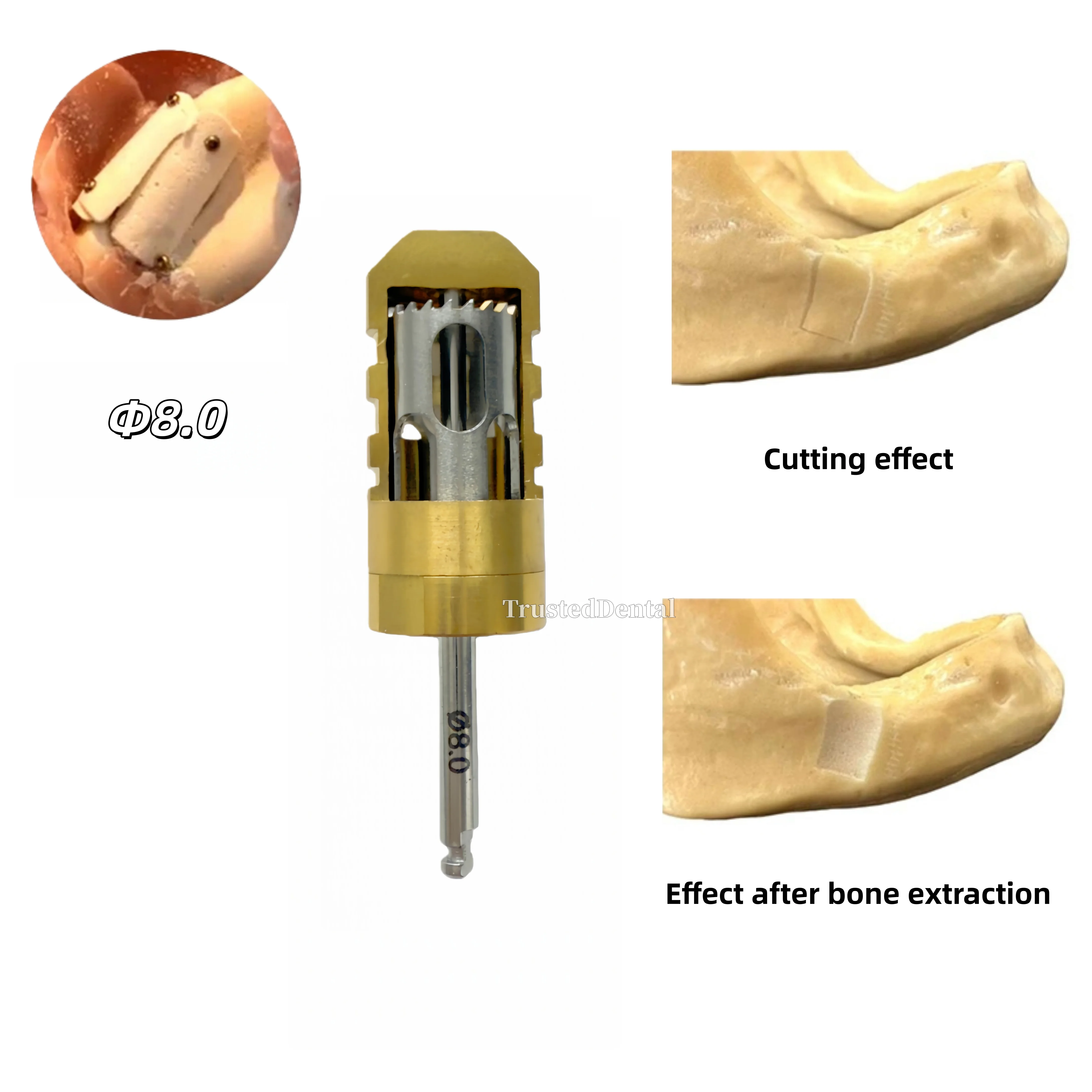 taladro-dental-para-cosecha-de-huesos-de-media-luna-implante-de-argumentacion-osea-trephine-Φ80mm