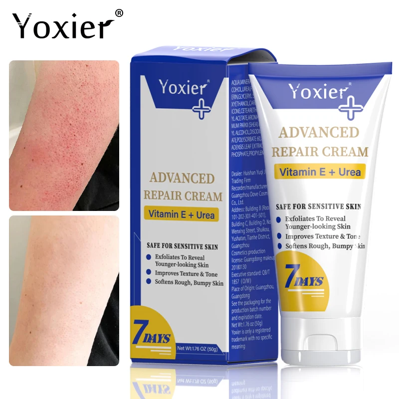 Keratosis Pilaris Repair Cream Vitamin E Skin Care Moisturizing Remove Hard Lumps Dry Rough Adjust Skin Tone Tighten Skin 50g