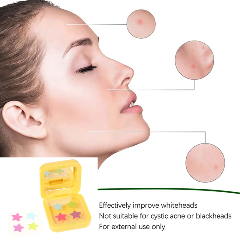 1Box 32 Patches Acne Patch Fade Repair Invisible Acne Removal Stickers Four-color Concealer Makeup Tool Star Style With Mirror