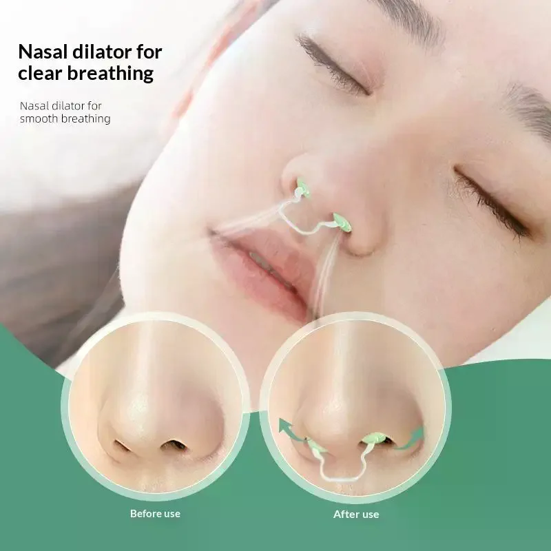 

5/10pcs Disposable U-shaped Nasal Dilator Sponge Nose Clip Breathing Relieve Anti Snoring Nose Soft Health Care