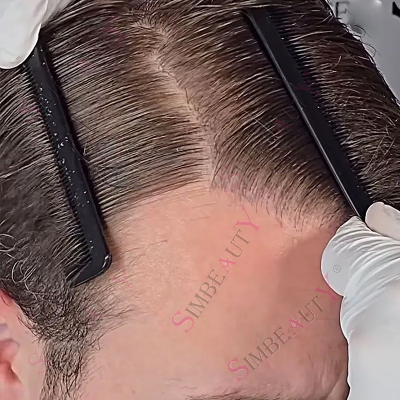 

80%Density 0.02mm Undetectable Ultra Thin Skin Dark Brown Men Toupee Black Grey 1B20 Human Hair System Natural Hairline Prosthes