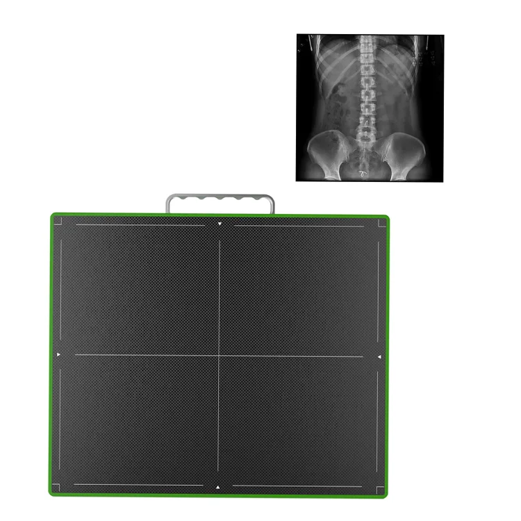 Medical X-ray Equipments & Accessories Wireless And Wired Flat Panel Detector Digital Radiography DR 14*17