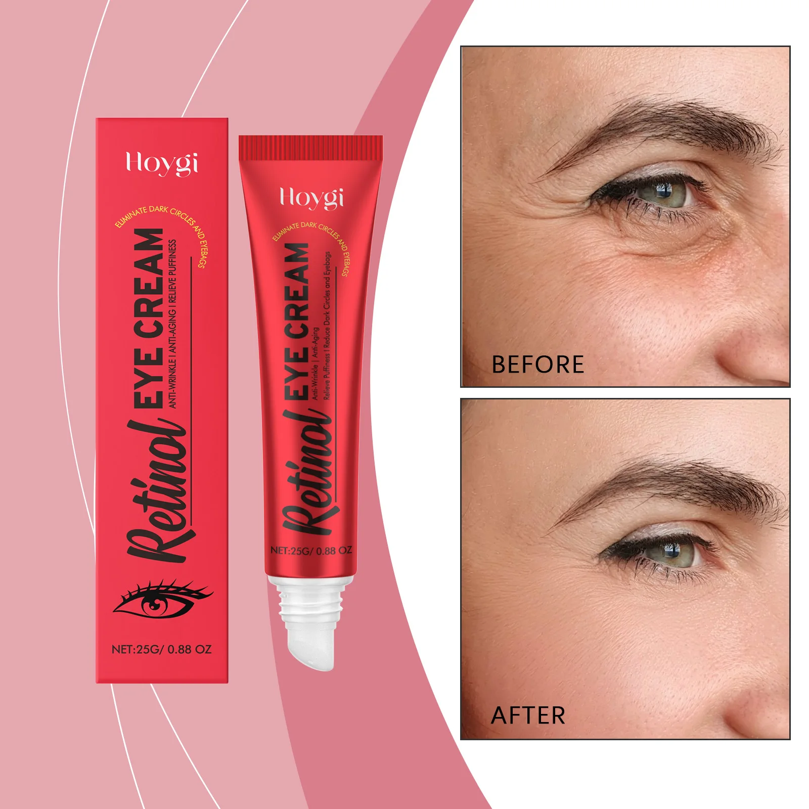 레티놀 아이 크림 - 다크서클 및 붓기를 위한 0.88온스 주름 방지 트리트먼트 |   피부과 전문의가 민감한 피부를 위해 부드러운 테스트를 거쳤습니다.