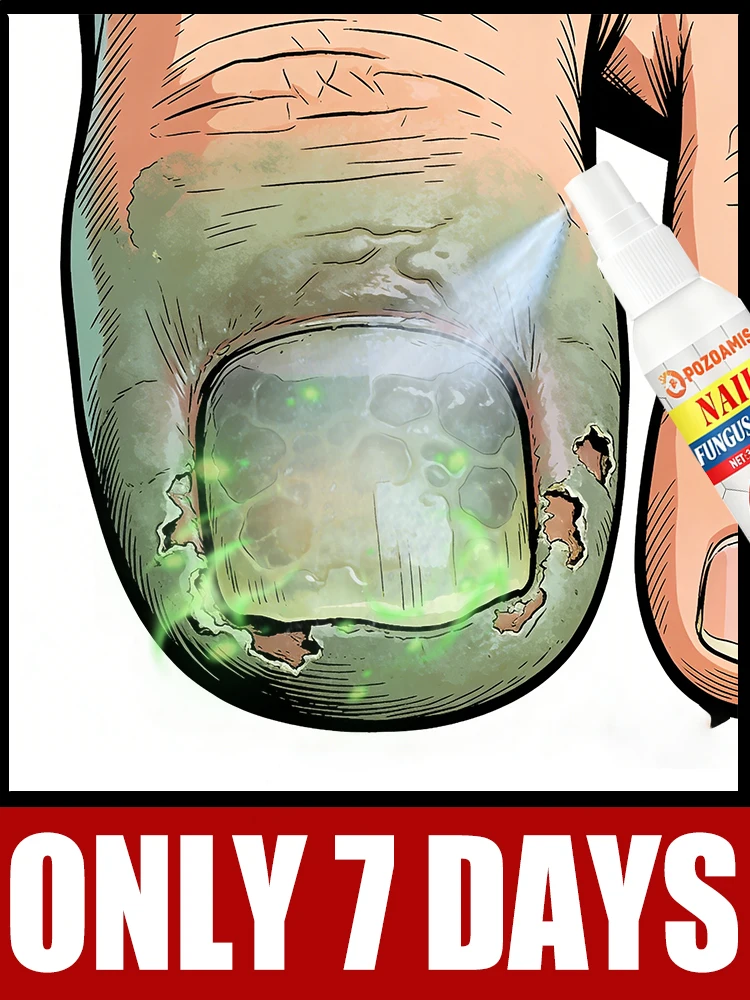 

Quickly get rid of toenail fungus, see smooth nails in 7 days. ⁿᵃⁱˡˢ ⁱⁿ ⁷ ᵈᵃʸˢ‧