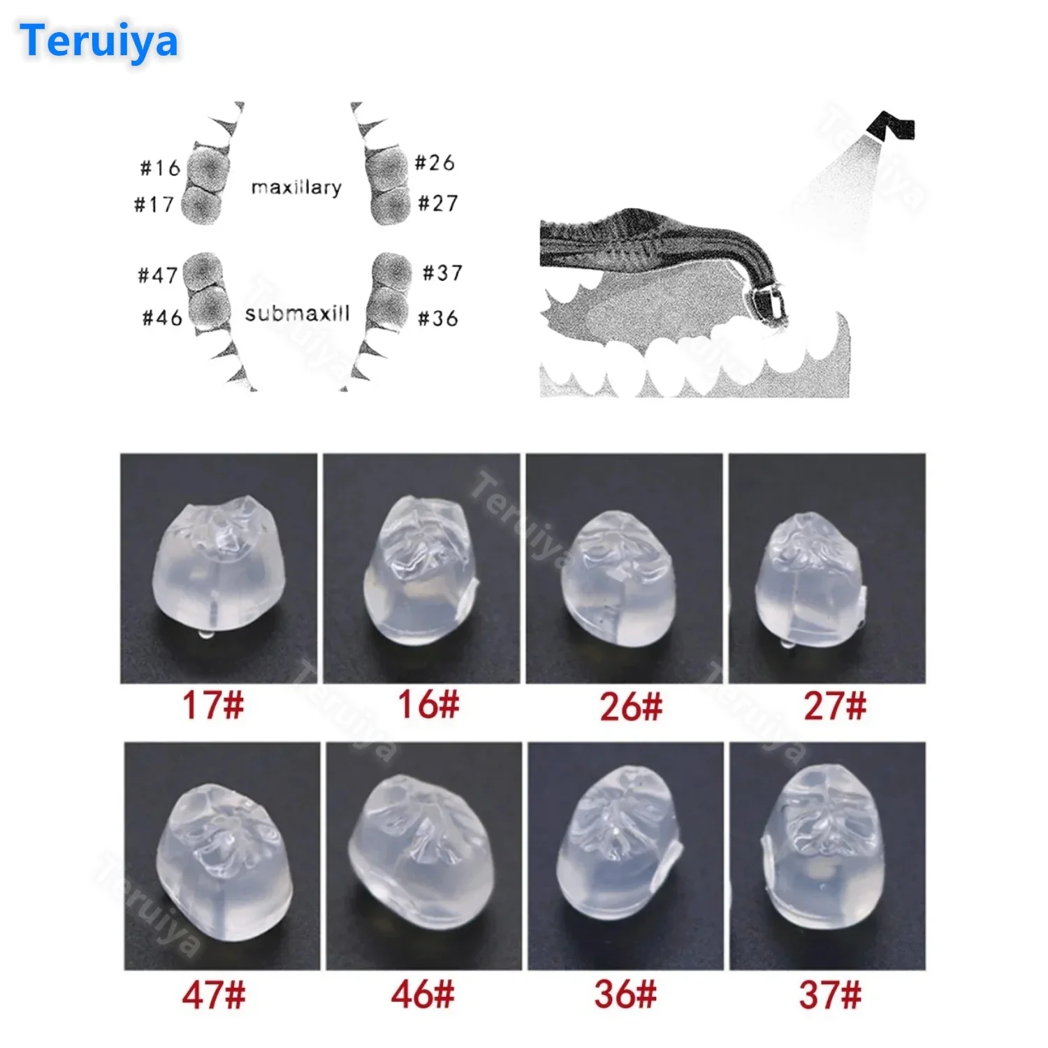 16Pcs/Box High-End Dental Posterior Teeth Mould Kit - Resin Reshape Fissure Stamp for Aesthetic Restoration & Filling