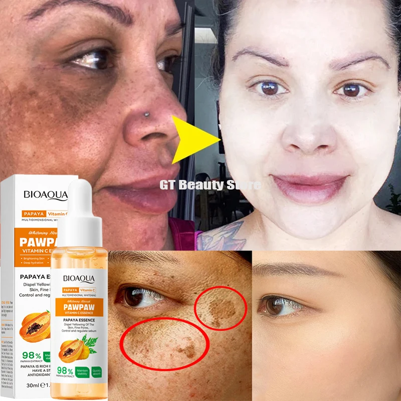 Whitening Serum Effective Remove Freckle Liquid Fade Melasma Dark Spots Fade Melanin Whiten Brighten Korea Skin Care Products