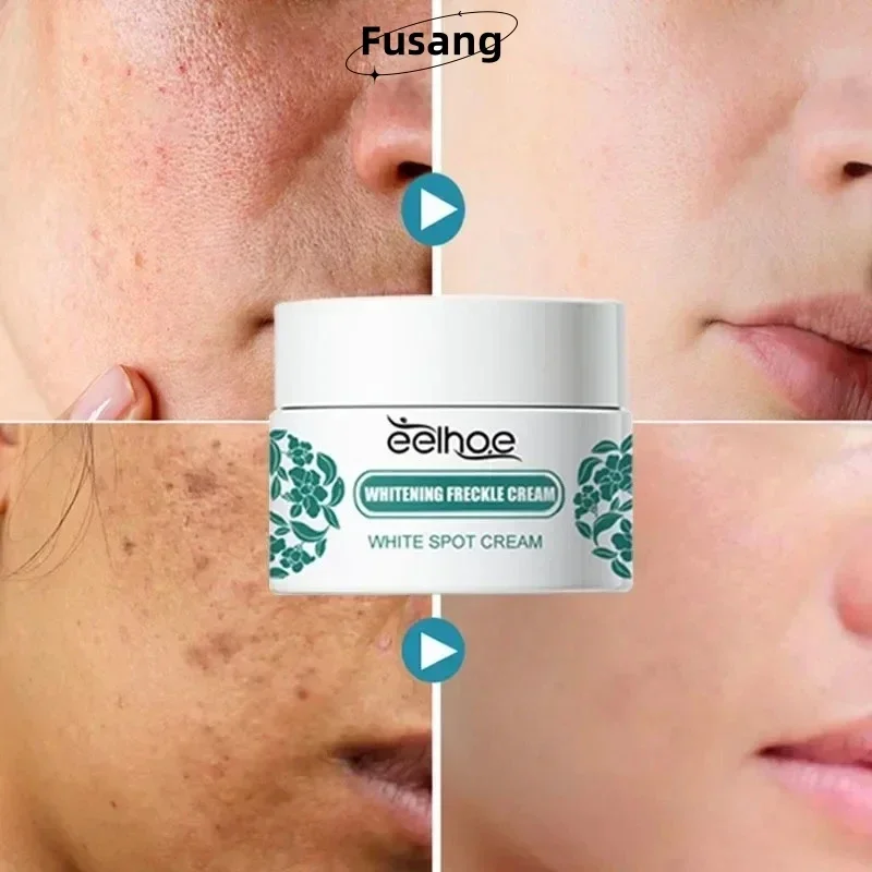 

Remove Melasma Face Brightening Cream Fade Fine Lines Women Moisturizing Lightening Facial Skin Care Cream