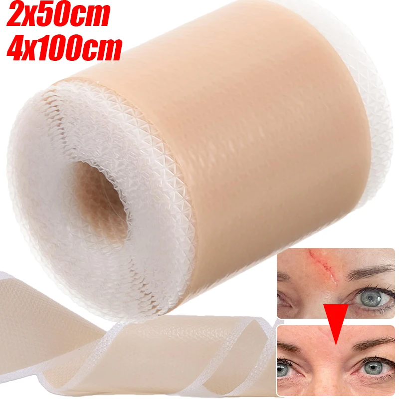 1 Roll Silicone Self-Adhesive Scar Sheets Covering Patch Waterproof Breathable Body Hand Skin Care Tape Tattoo Accesories