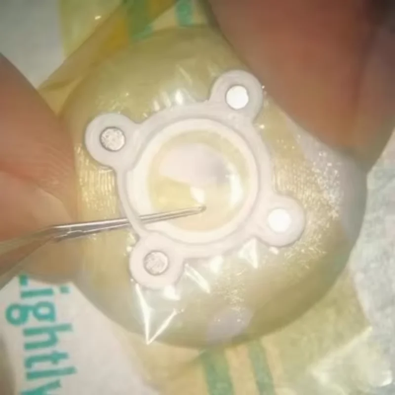2.0/3.0 Ophthalmology Phacoemulsification Capsulorhexis Forceps Circular Capsule Operation Practice Model +1/2/3M Film
