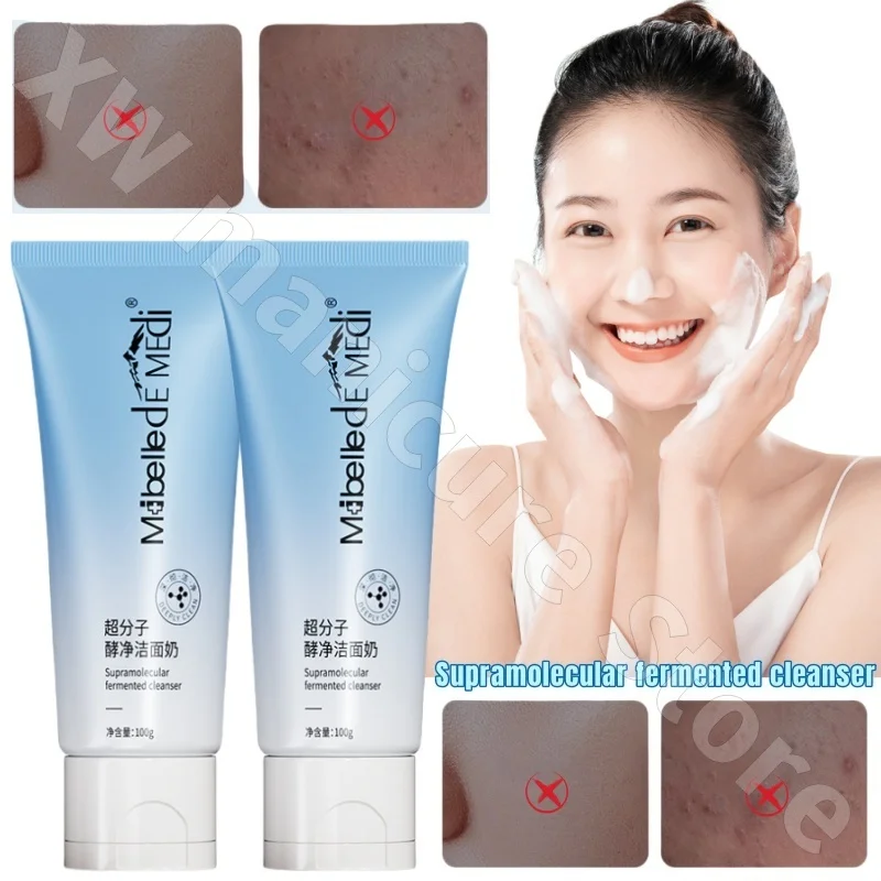 Amino Acid Facial Cleanser Deep Cleaning Without Tightness, Dense Foam Soothing Oil-control Makeup Remover Cleanser 100g