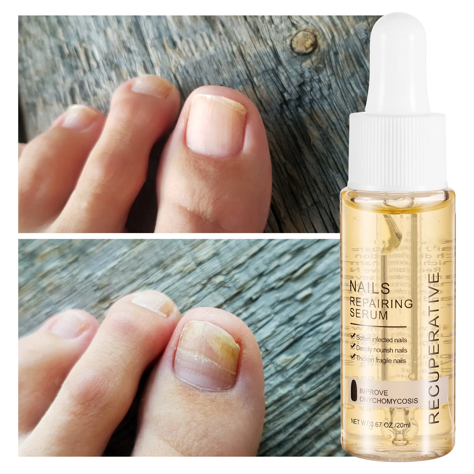 1Pcs Treatment Repairing Serum Nourishing Essence Nail Care Solution Onychomycosis Repair Moisturizer