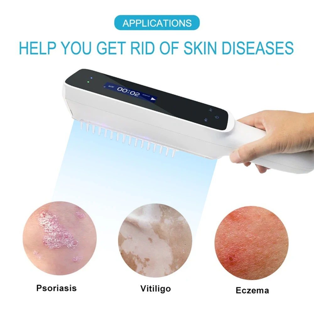 UV 311nm Ultraviolet Phototherapy Device Uses Philips Lamp UVB To Treat Vitiligo, Psoriasis, White Spots And Skin Disease