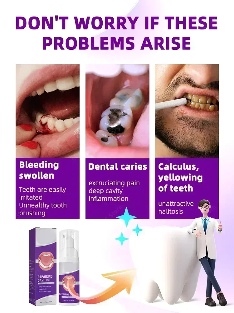 Oral Hygiene Teeth Cleaning Whitening Teeth Stains Alculus Plaque Periodontitis Freshen Bad Breath Remove Cavities Toothpaste