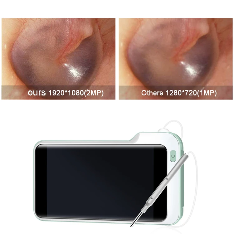 P50 5inch IPS Screen 3.9mm 3MP beauty & personal care products ear wax remover ear cleaner with camera