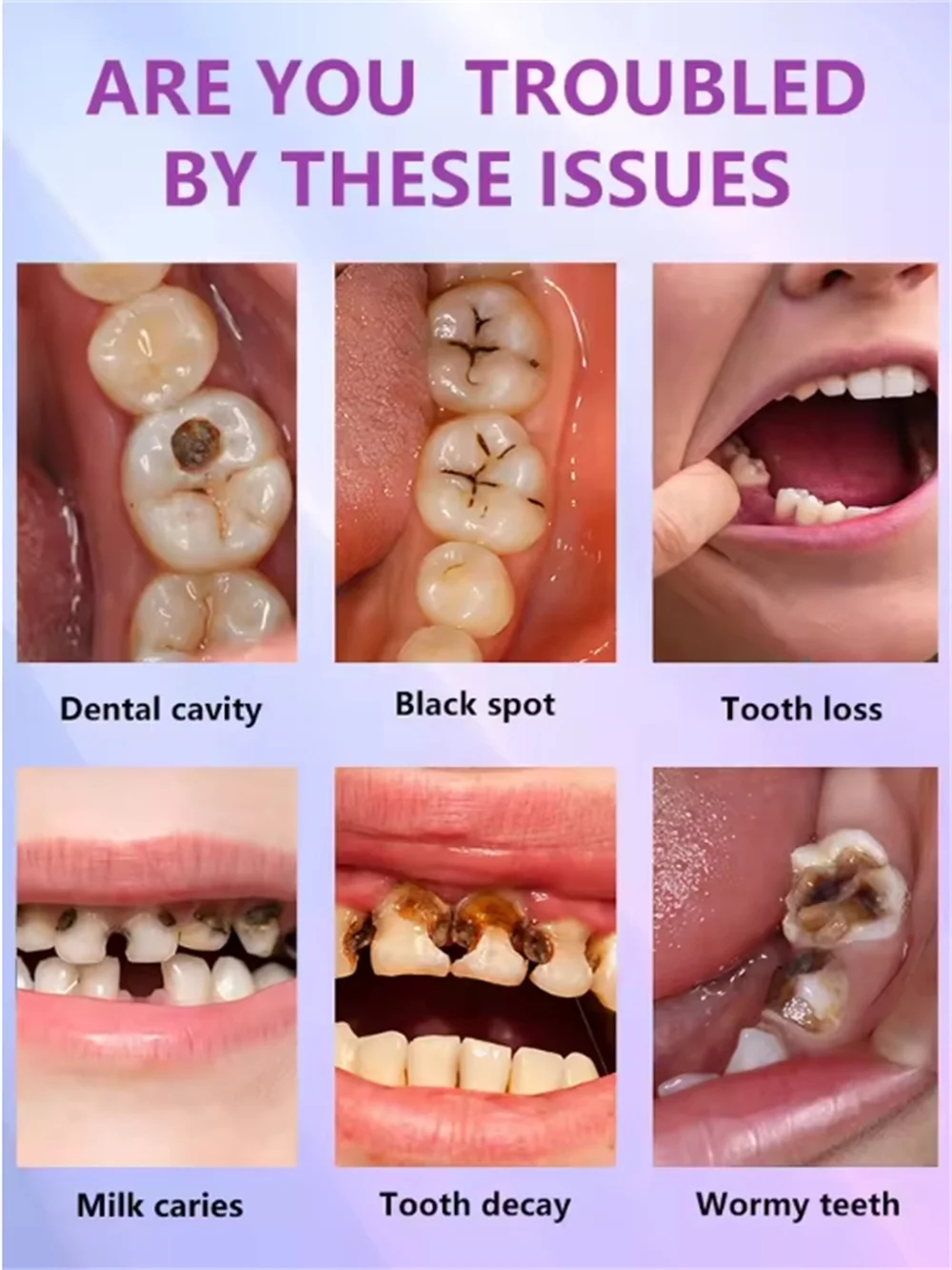 Tooth decay Repair Repairing Cavities Anti Protecting Caries