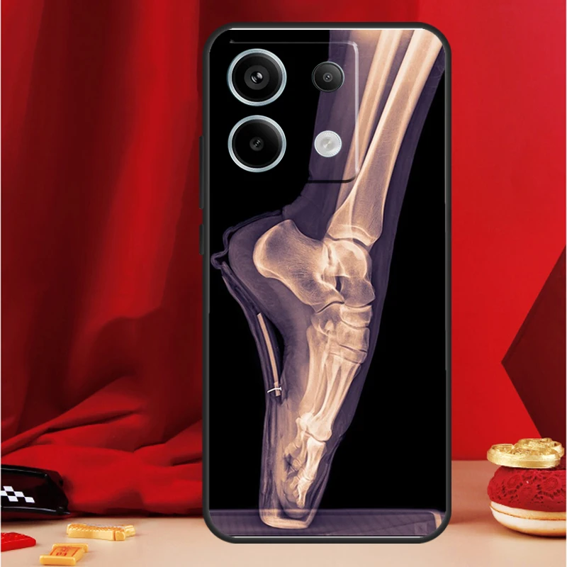 X-Ray 인체 해부학 케이스 Xiaomi Redmi Note 11 12 13 Pro 8 9 10 Note 12S 11S 10S 9S Redmi 13C 10C 12C 커버