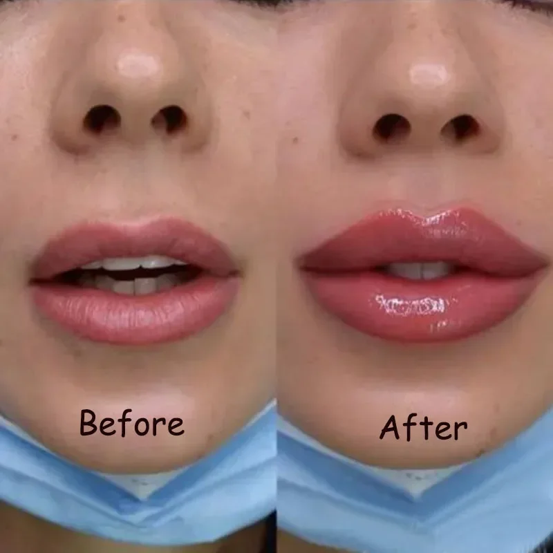 Suero labial regordeta, Reduce las líneas finas, aumenta la elasticidad de los labios, voluminizador instantáneo, reparación de aceites esenciales, nutre, belleza Sexy, cuidado de los labios