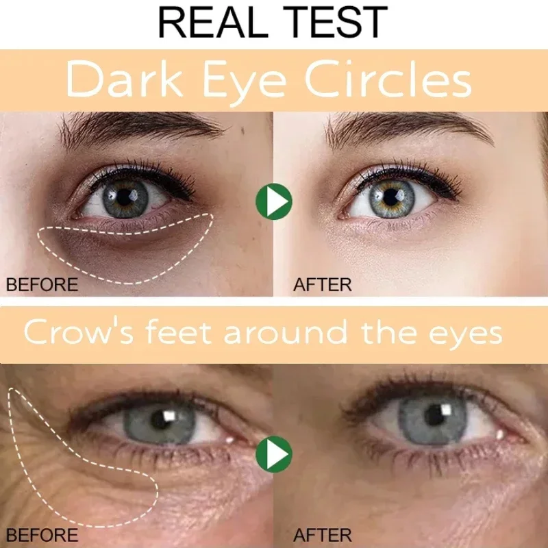 Instant Eye Bag entfernen Augen creme Anti-Fett-Partikel Augenringe Schwellungen verblassen feine Linien Lift erhellen koreanische Schönheit Augen pflege