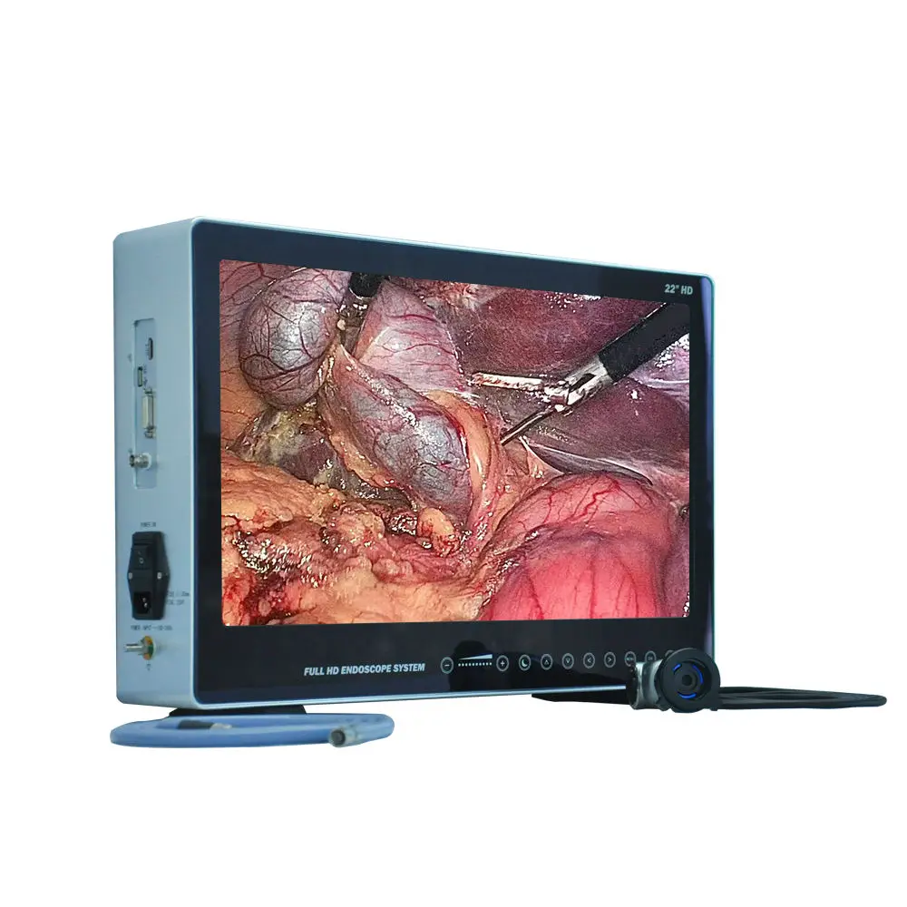 Medical Full HD Endoscope Camera System with 24 Inch Monitor, 80W Led Light Source and Record Function