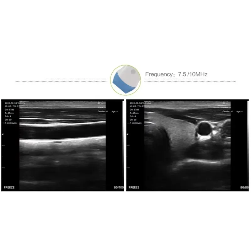 

2025/High end veterinary Wireless ultrasound for animals Liner probe Ultrasound Mini Wifi 5G Color Doppler Ultrasound