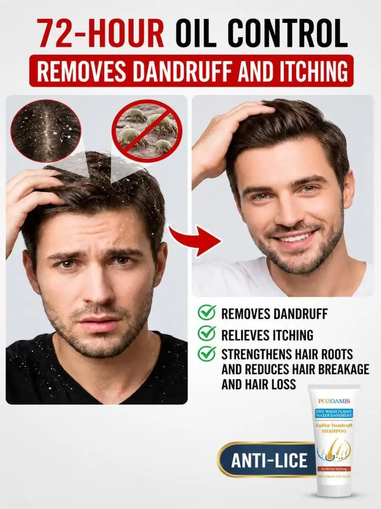 Unisex Sulfur Infused Shampoo Deep Scalp Cleansing Formula Soothe Scalp Discomfort Nourish Hair Root Help Reduce Visible Dandruff For Household Daily Hair Care Washing