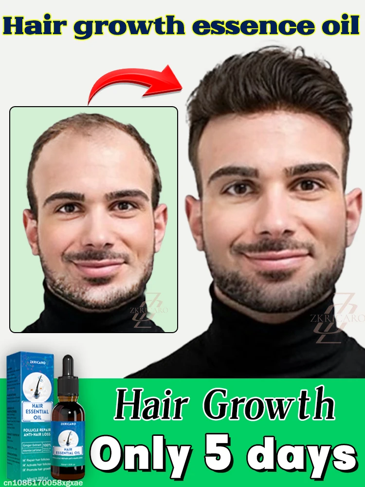 

Эссенция для ухода за волосами I масло. Самый переустановленный рост волос oiI. Дает вы густым волосам