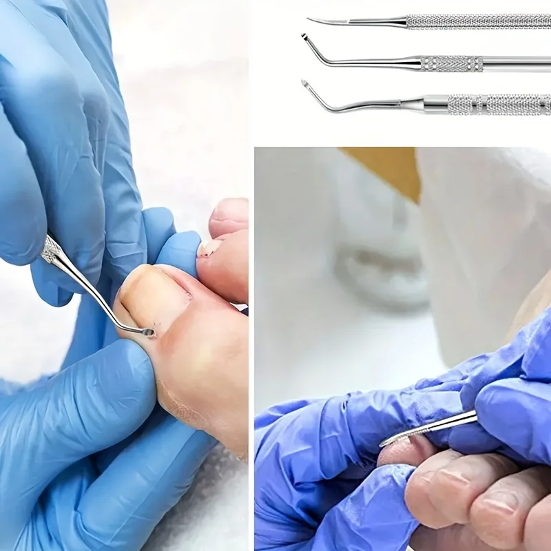 Thumbnail 4 - #38 Best Nail Tools to Buy In 2026