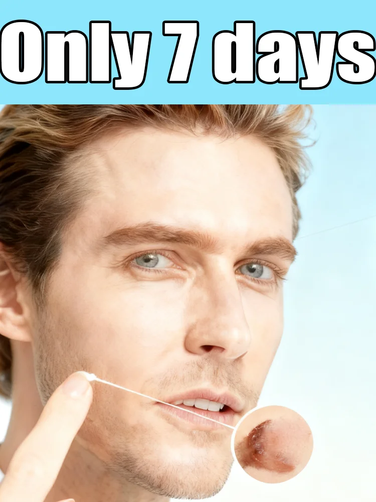 

Gᴇɴᴇʀᴀᴛɪᴏɴ-2 Lᴀsᴇʀ Sᴀʏs Gᴏᴏᴅʙʏᴇ Tᴏ ᴀʟʟ ᴡᴀʀᴛs Iɴ 7 Dᴀʏs